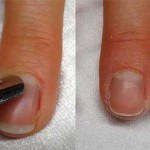 Nagelhaut zurück schieben