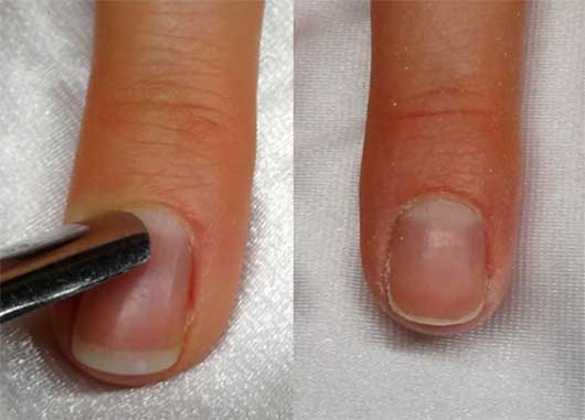 Anleitung Nailart Mit Frenchspitzen Wunderschön